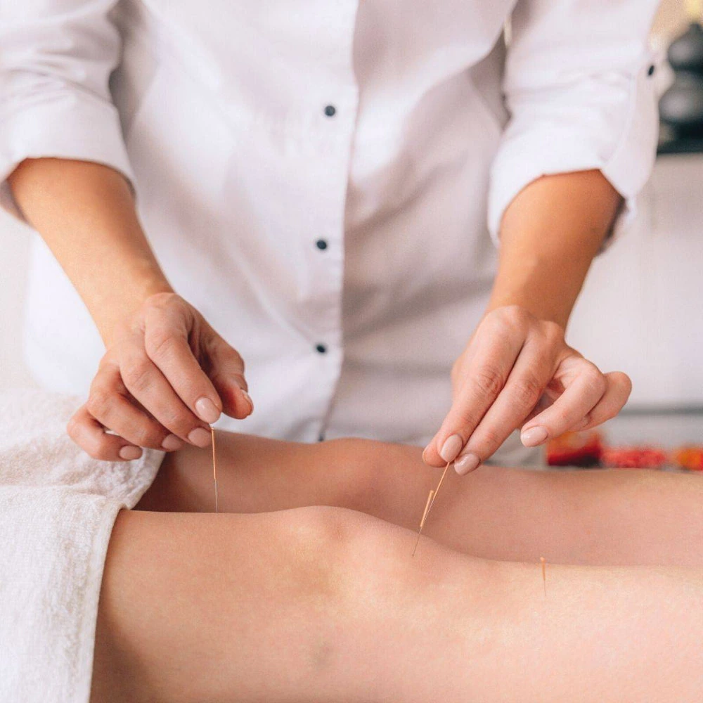Acupuncture treatment in progress at Aujaswa Clinic