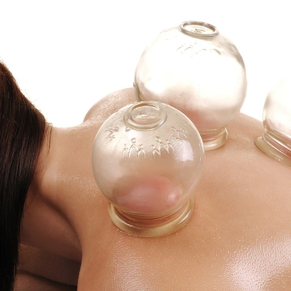 Cupping therapy session