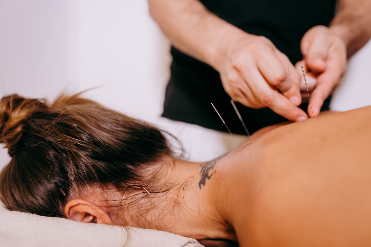 Acupuncturist administering treatment on patient's back